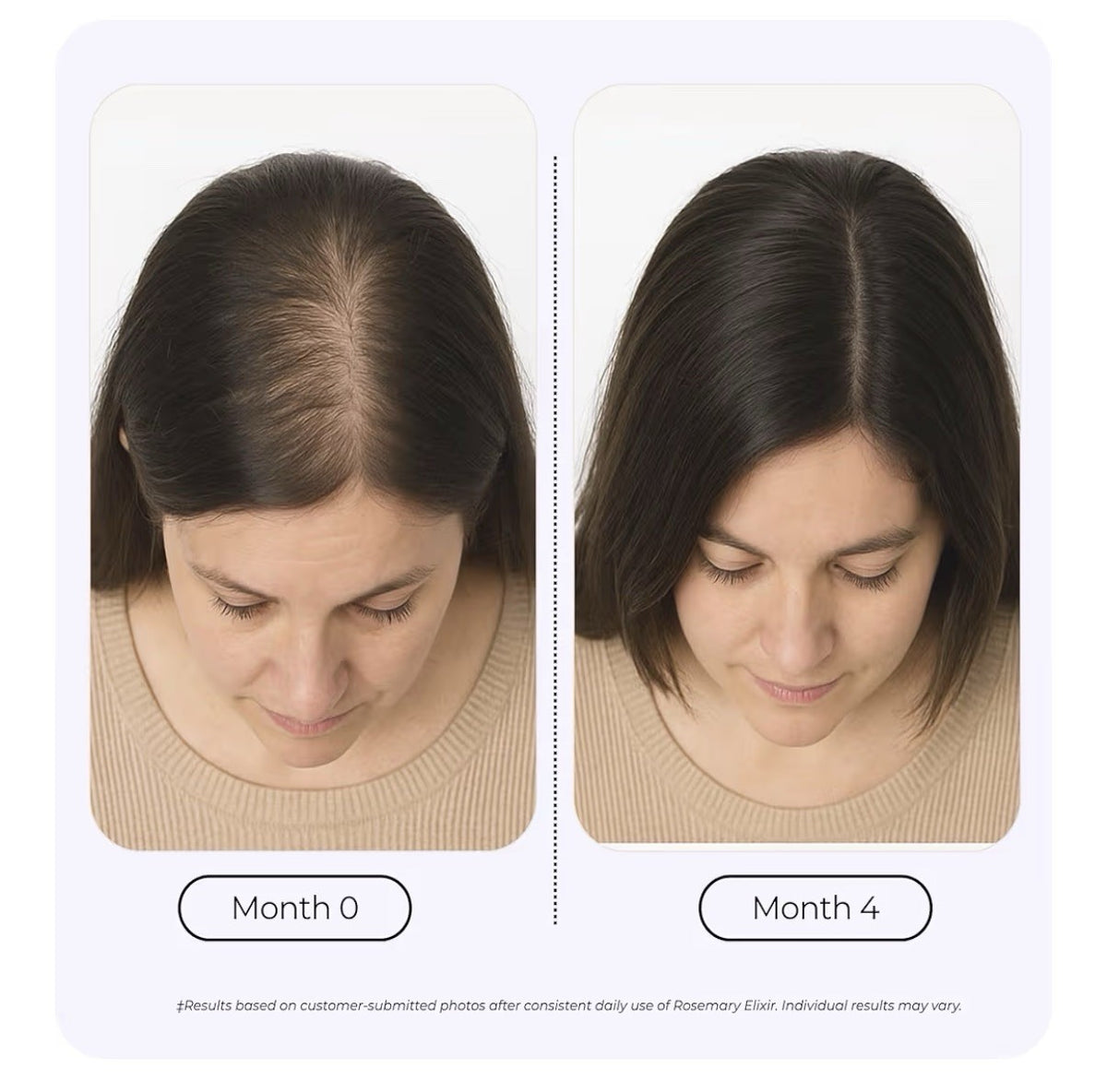 Growplex Rosemary Elixir Daily Scalp Oil with 9 Essential Oils Healthy Scalp 2oz
