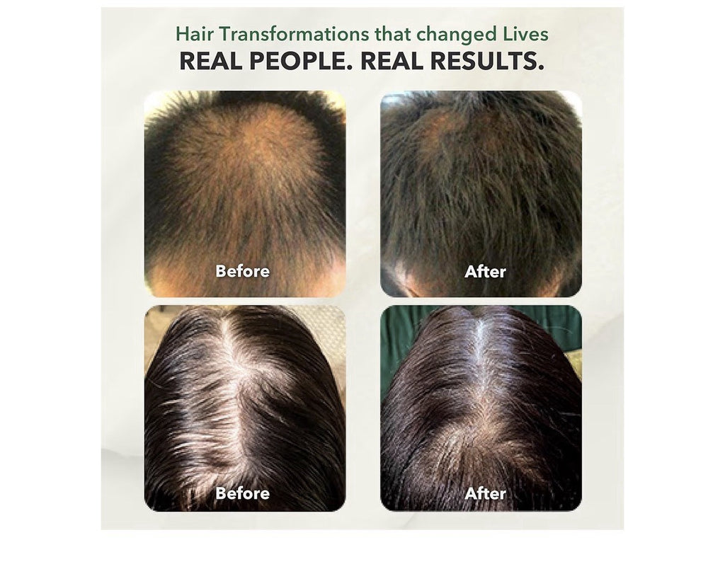 HairSmart H5 Grow+ Hair Vitamin Supplement Biotin Ayurvedic Herbs 5 Nutrient 90c