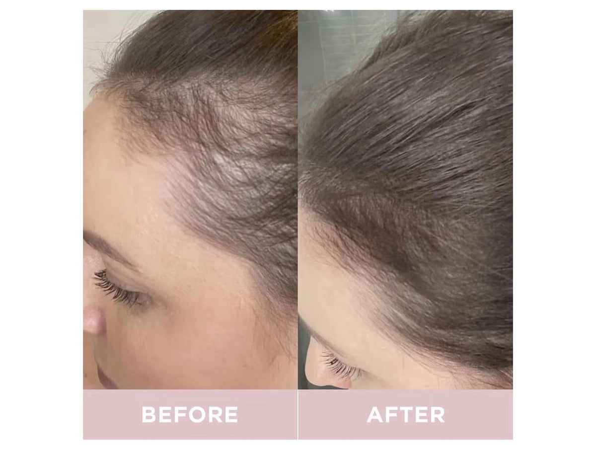 Revive Collagen Enhanced Plus Premium Liquid Marine Collagen Drink Supplement