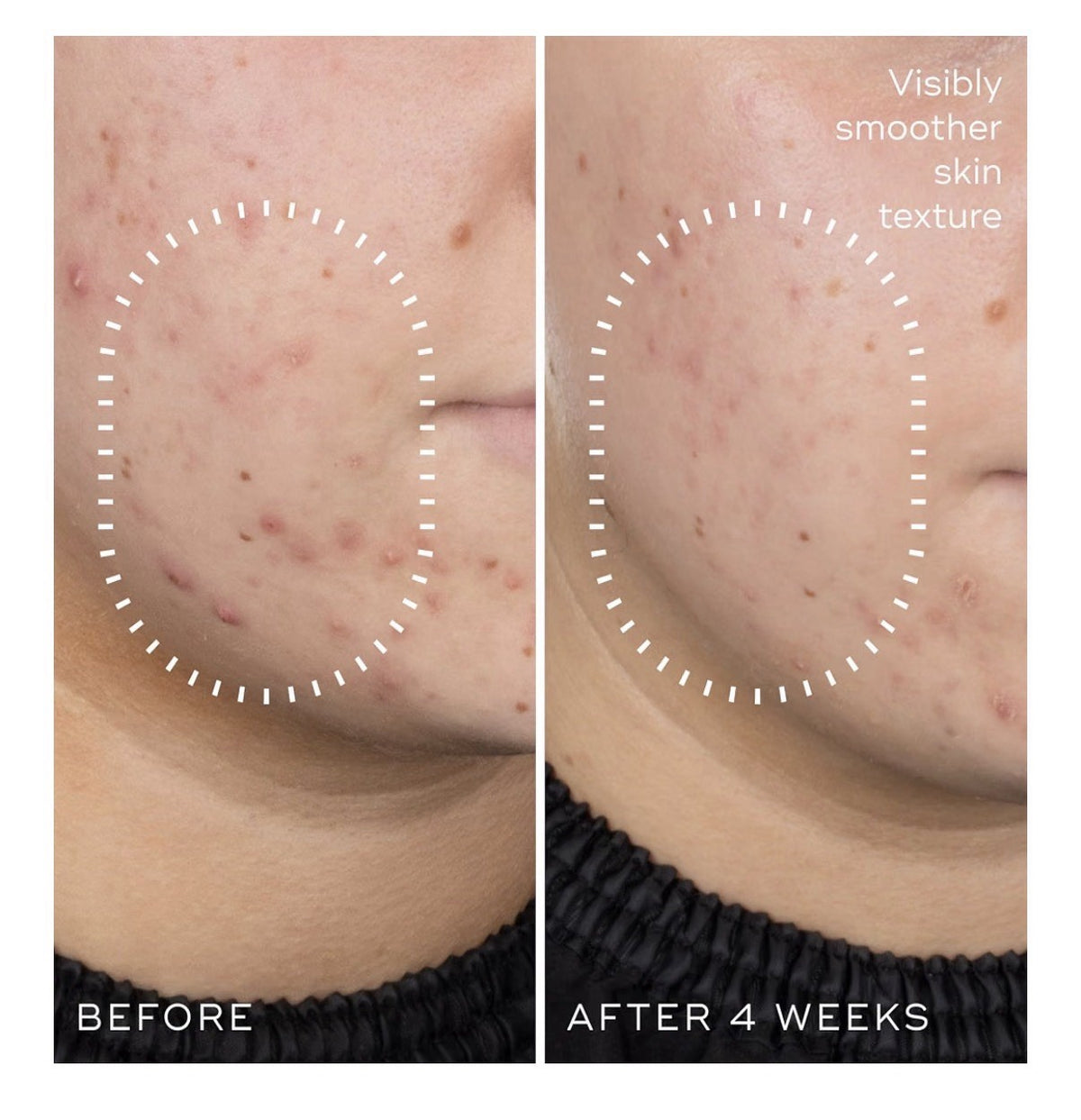 Medik8 Niacinamide Peptides Balancing Pore-Refining Serum Face Visibly Clear 1oz
