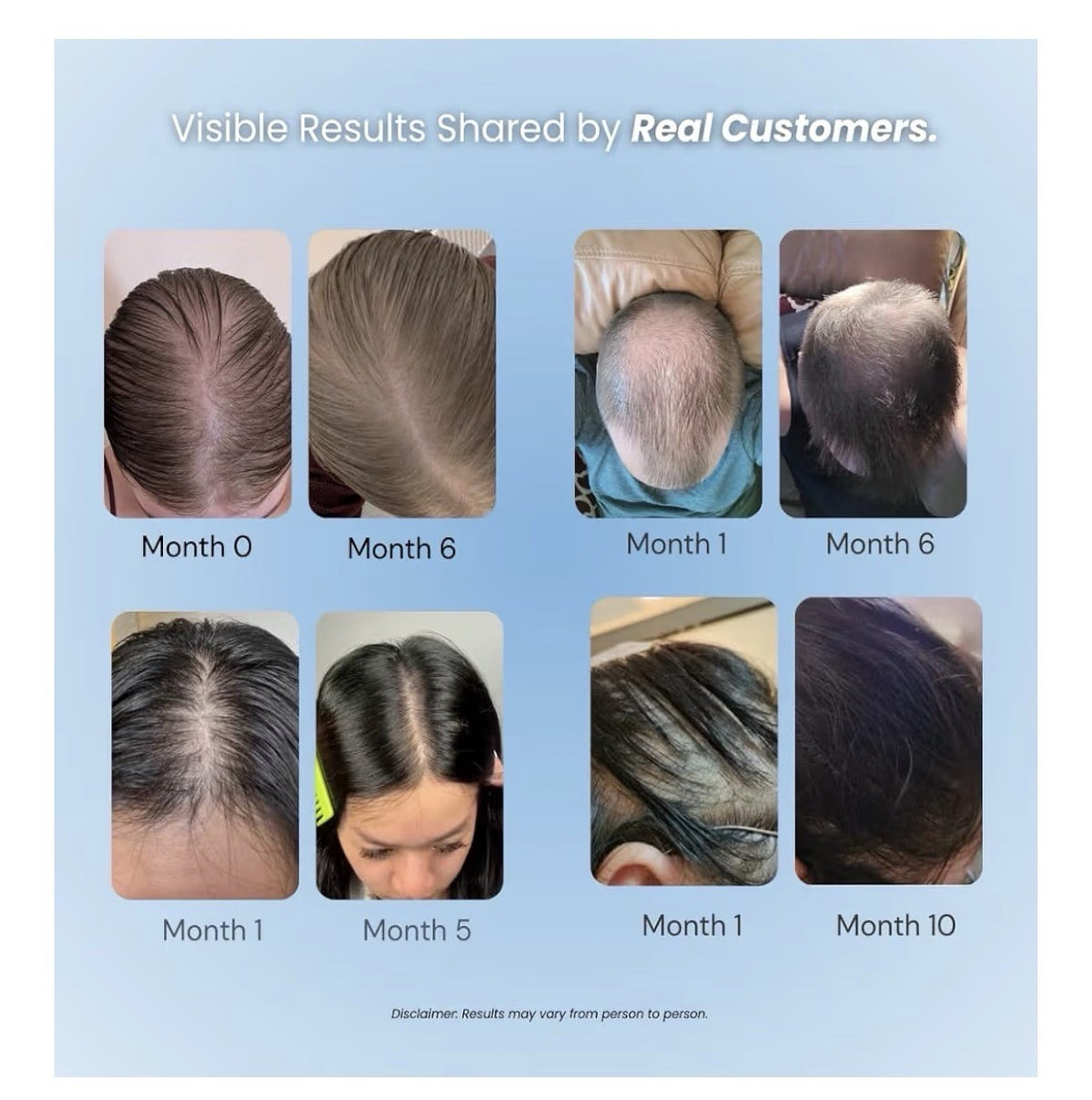 Growplex Vitafoam Hair Growth Bundle Scalp Care Foam + Complex10 Hair Supplement