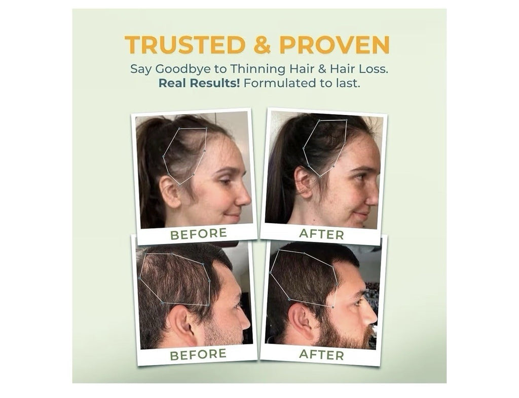 Vital Nutritive Vital Hair Complex Hair Skin Nails Health for Women & Men 120cap