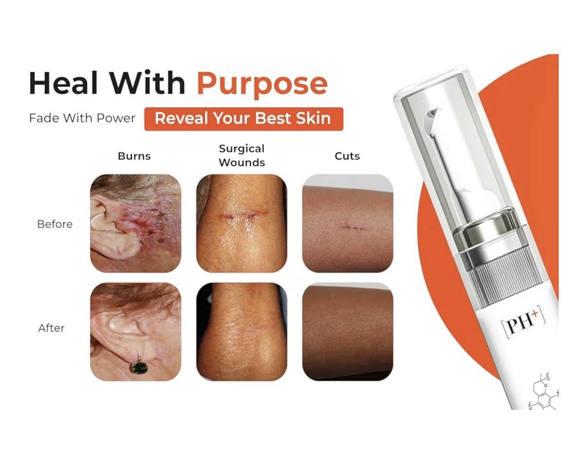 PureHealPlus Silicone Scar Gel for Old &New Scars Burns Acne Surgical Scars 13ml
