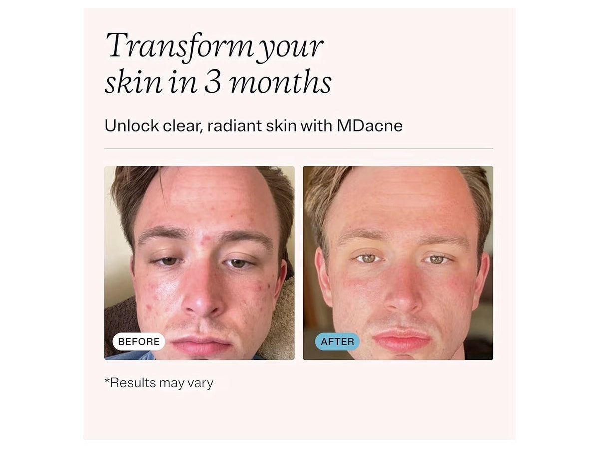MDacne Vitamins + Minerals Clear Calm Skin Redness Customized Supplements 3 Pack