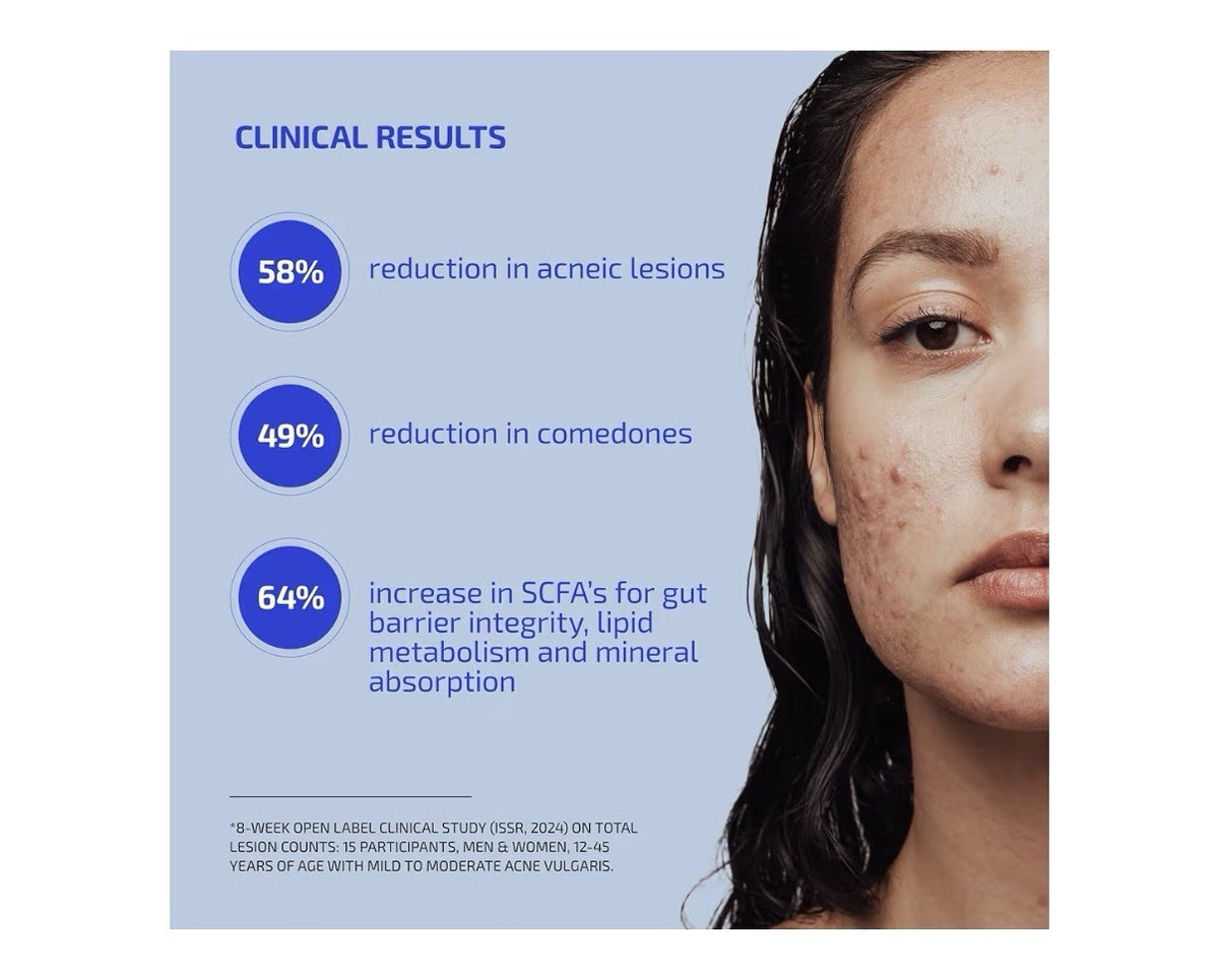 Codex Labs Shaant Clear Skin 2.0 Acne Prone Probiotics Supplement 60 Capsules