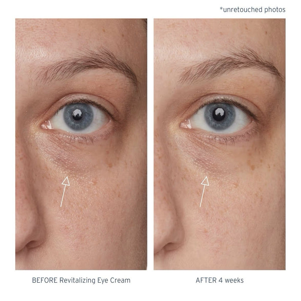 Santo Remedio Piel Eterna Revitalizing Eye Cream Helps Reduce Dark Circles 1oz