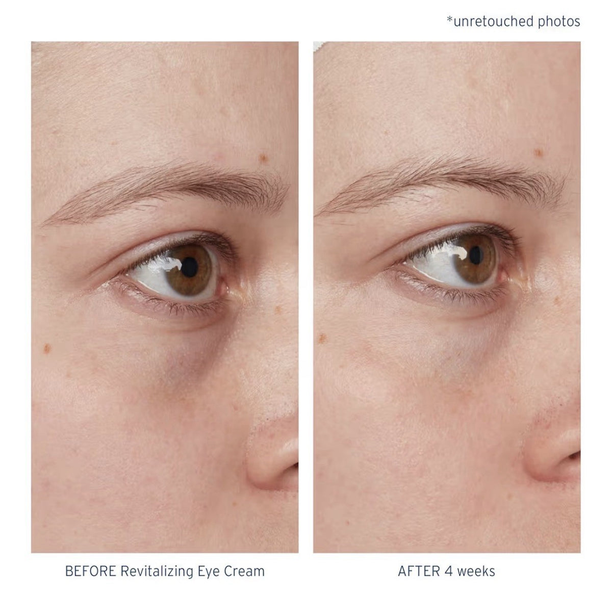 Santo Remedio Piel Eterna Revitalizing Eye Cream Helps Reduce Dark Circles 1oz