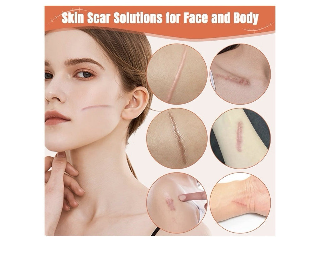 2 Pack BARUBT Scar Solutions Silicone Scar Stick All Skin Types New Old Scars