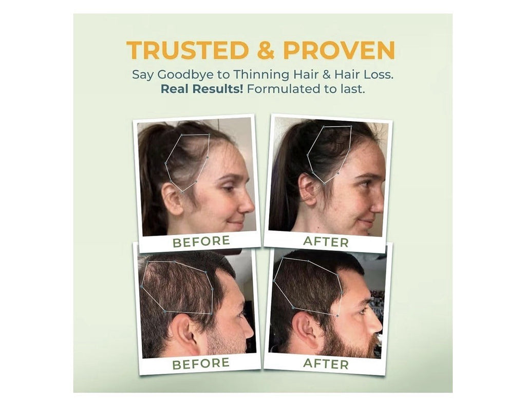 Vital Nutritive Vital Hair Complex Hair Skin Nails Health for Women & Men 60caps