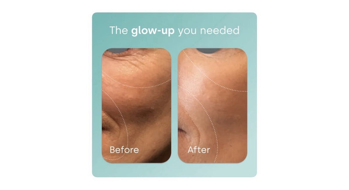 Biosil Collagen Generator Booster Supplement Hair Skin Nails Joint Support 30cap