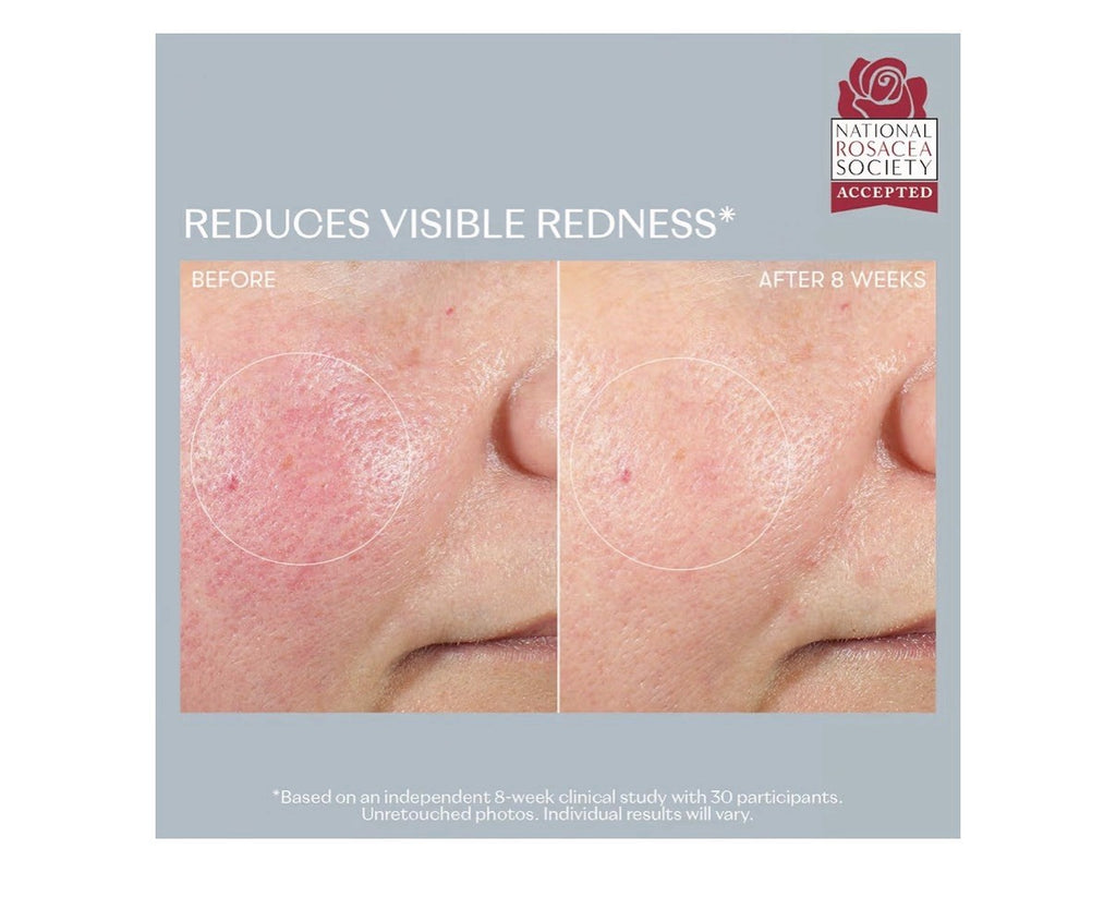 RescueMD Skin DNA Repair Complex Scar Treatment Serum PostProcedure Redness 15ml
