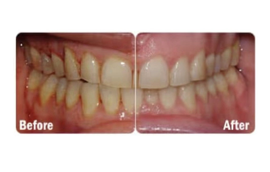 2 Pack ProBiora Kids Probiotic Oral Care Gum Teeth Health Chewable Orange