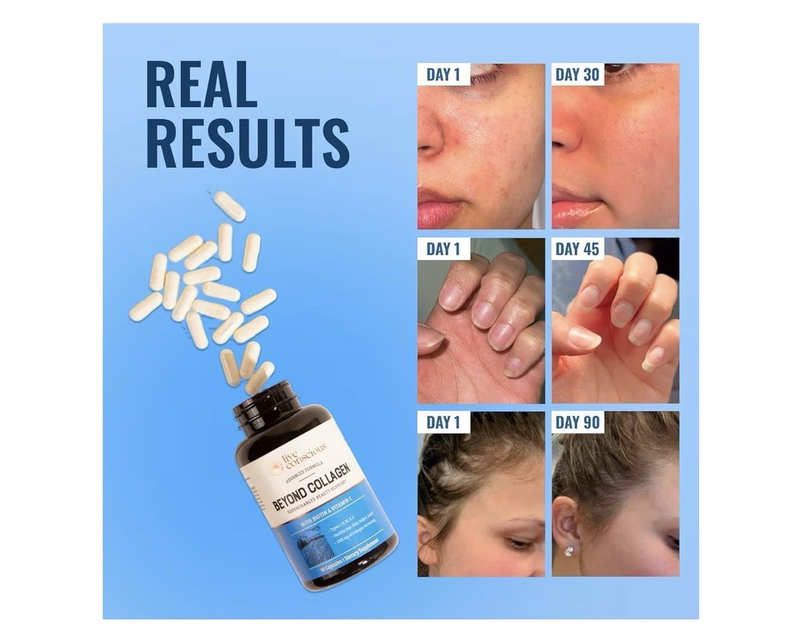 Live Conscious Beyond Collagen Types I II III V X Supercharged Beauty 2 Pack