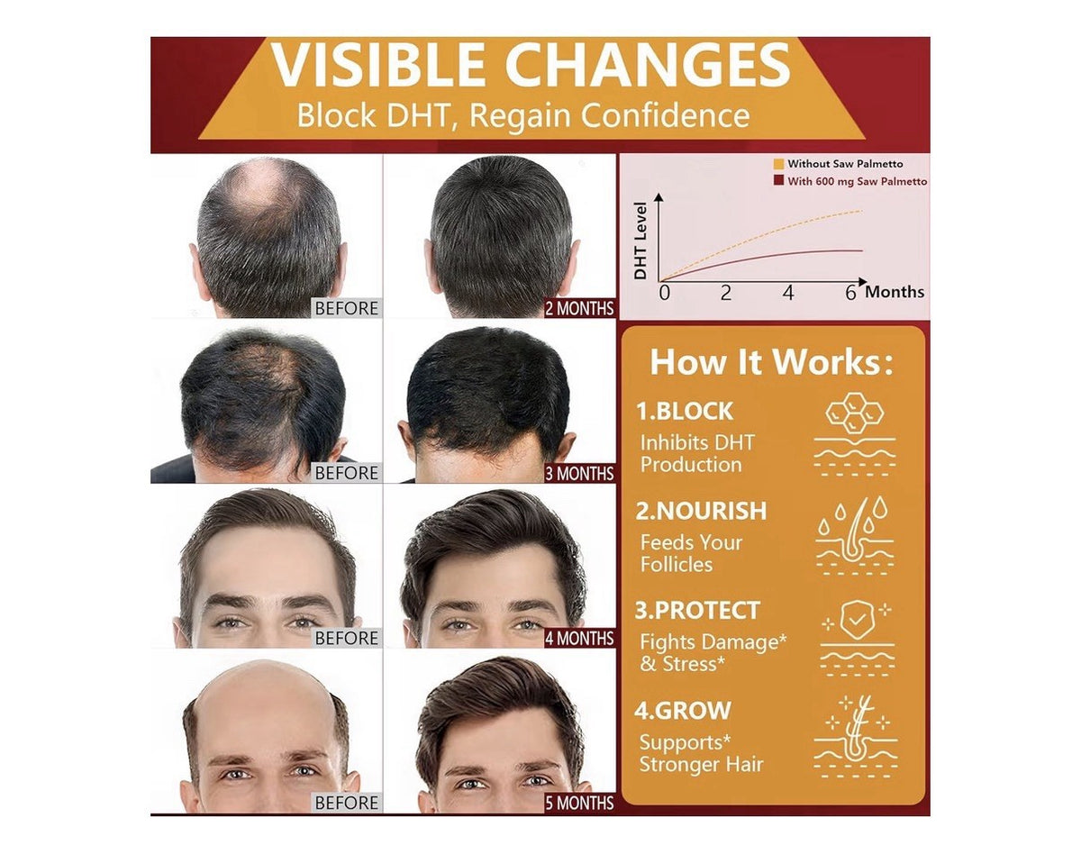 2 Pack HevChay DHT Blocker for Men Extra Strength Advanced Hair Growth