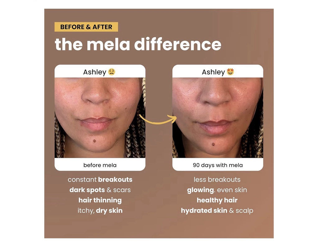 Mela Daily Glow for Healthy Melanin-Rich Skin Textured Hair Glowing Skin 60 Caps
