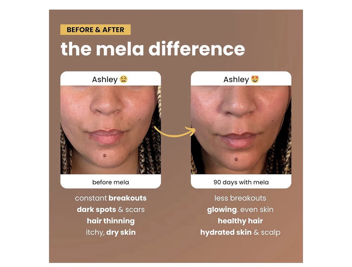 Mela Daily Glow for Healthy Melanin-Rich Skin Textured Hair Glowing Skin 60 Caps